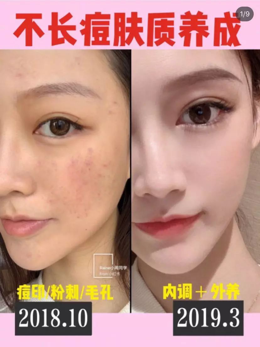 小红书如何涨粉？